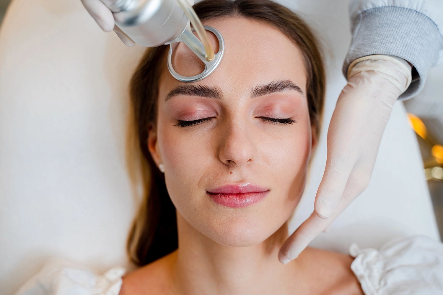 Laser CO2 Fracionado